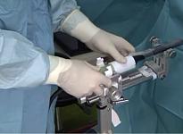 Отделение урологии и андрологии - фото 15