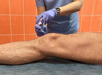 Внутрисуставные инъекции