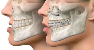 Челюстно-лицевой хирург в Челябинске - фото 2