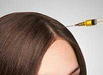 Трихология - фото 4