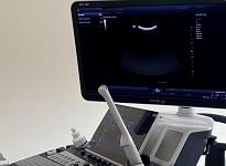 УЗИ урологическое - фото 3