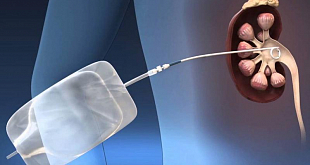 Прием уролога - фото 3