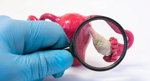 Язовских Татьяна Борисовна - фото 2