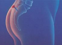 Отделение колопроктологии в Челябинске - фото 7