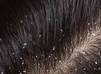 Трихология - фото 8