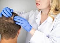 Трихология - фото 2