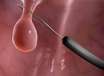 Отделение акушерства и гинекологии - фото 6