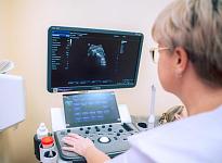 Гинекологическое УЗИ - фото 5