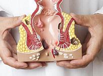 Отделение колопроктологии в Челябинске - фото 5