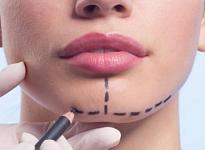 Челюстно-лицевая хирургия в Челябинске - фото 4