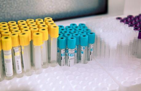 Какие анализы являются обязательными при прохождении гинеколога?