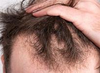 Трихология - фото 6