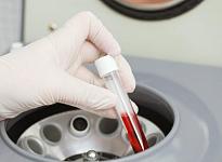 Отделение урологии и андрологии - фото 18