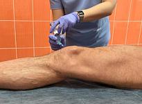 Уколы - фото 5