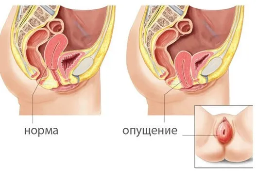 Анатомия женских половых органов. Киев, Печерск | 